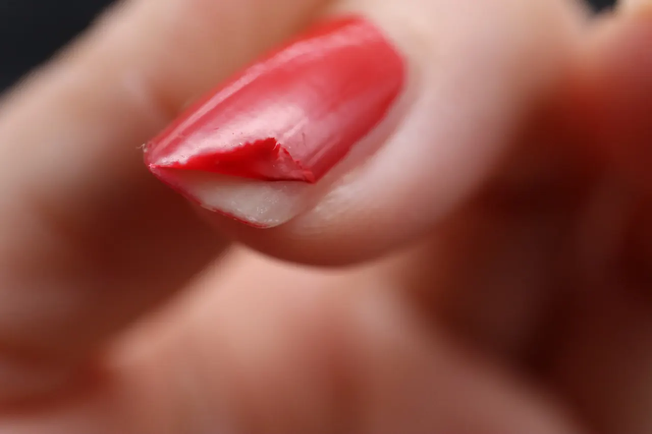 ネイルが剥がれている状態